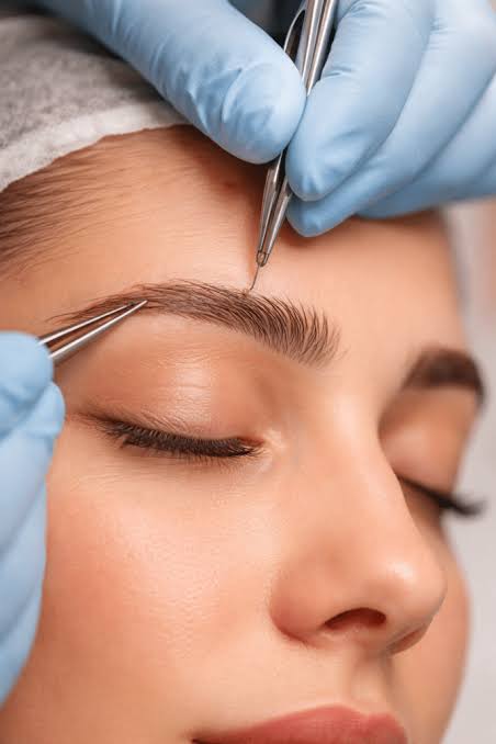 Eyebrow hair transplant procedure close-up
